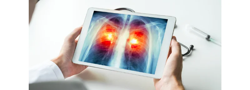 Smokers beware: No quick fixes to detox the lungs