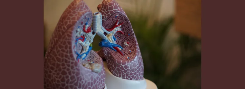FACT-CHECK: Decoding the ‘COVID-19 lung’