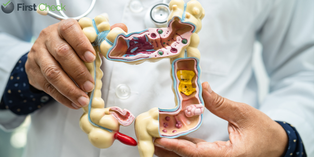 Explainer: Understanding Irritable Bowel Syndrome