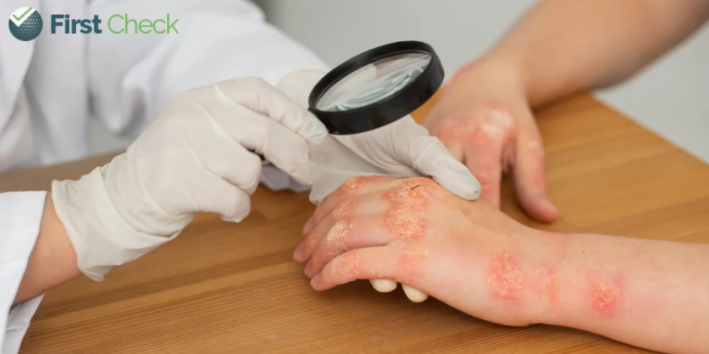 Rising mpox cases test Pakistan’s fragile healthcare system