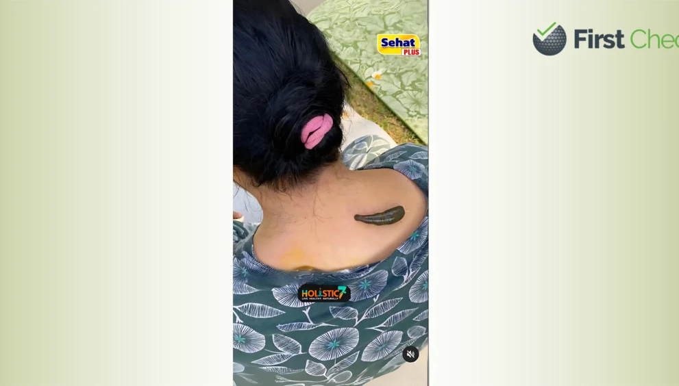 Viral claim about Leech Therapy for Cervical Pain lacks scientific backing