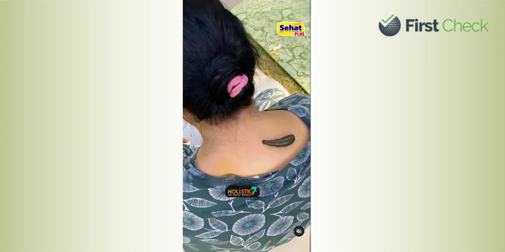 FACT CHECK: Viral claim about Leech Therapy for Cervical Pain lacks scientific backing