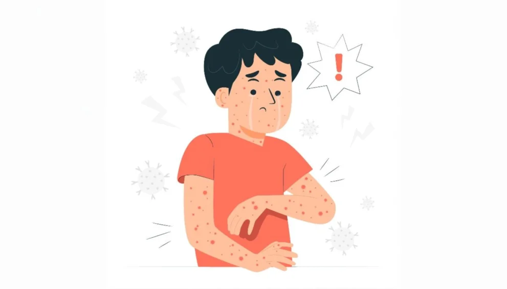 3 COVID era conspiracy theories make a comeback after mpox