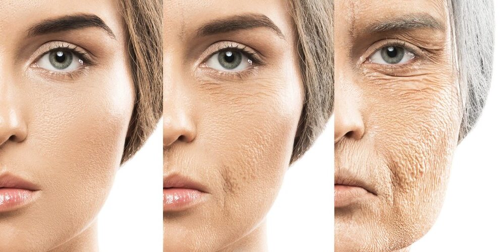 age