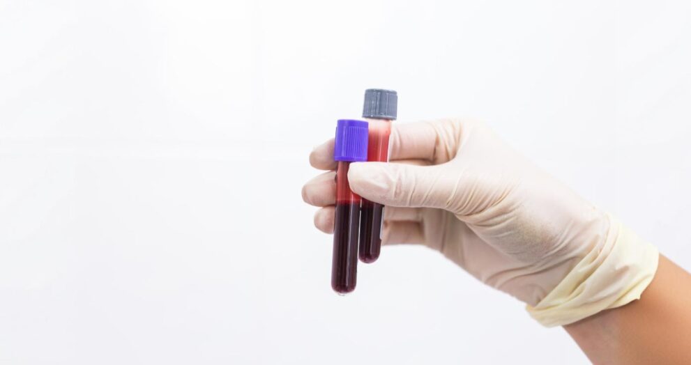 Blood group