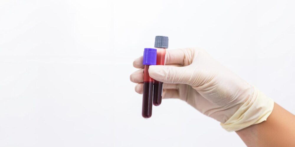 Fact Check: Are A, B and AB blood groups more prone to blood clotting, raising heart attack, stroke risk?