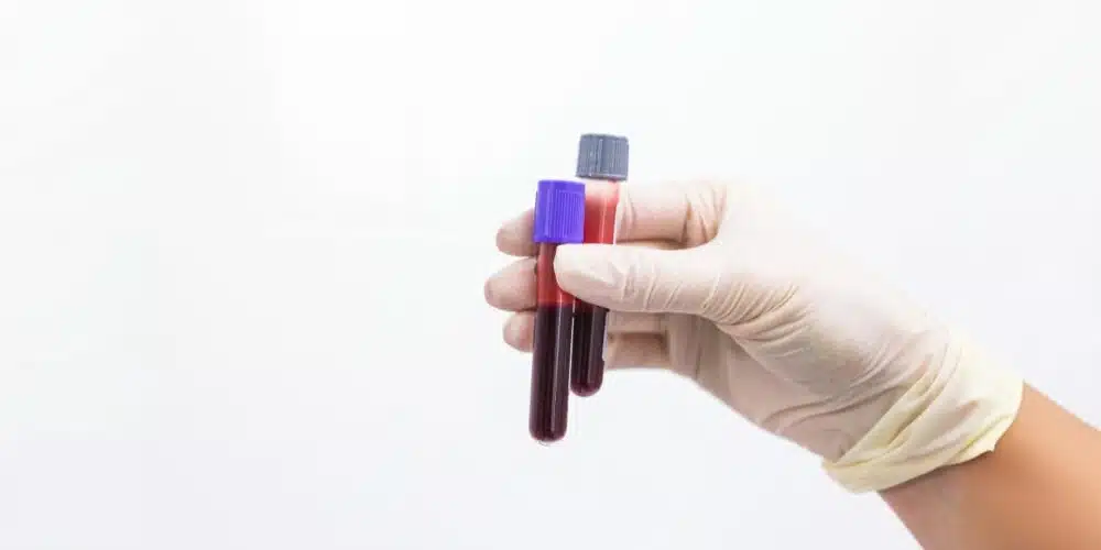 Fact Check: Are A, B and AB blood groups more prone to blood clotting, raising heart attack, stroke risk?