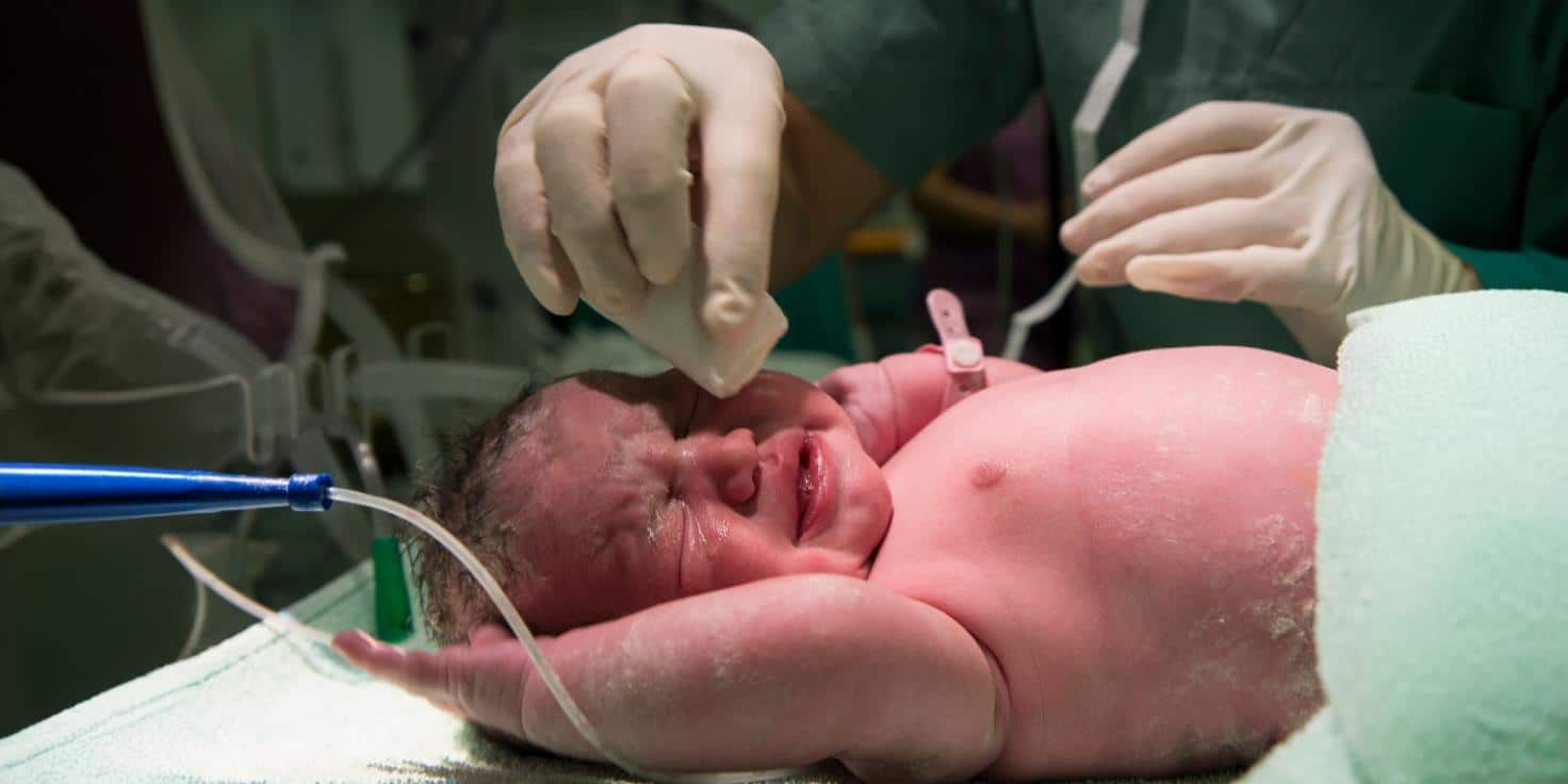 FACT CHECK: Can this weird head-pulling trick cure anxiety in adults born via C-Section?
