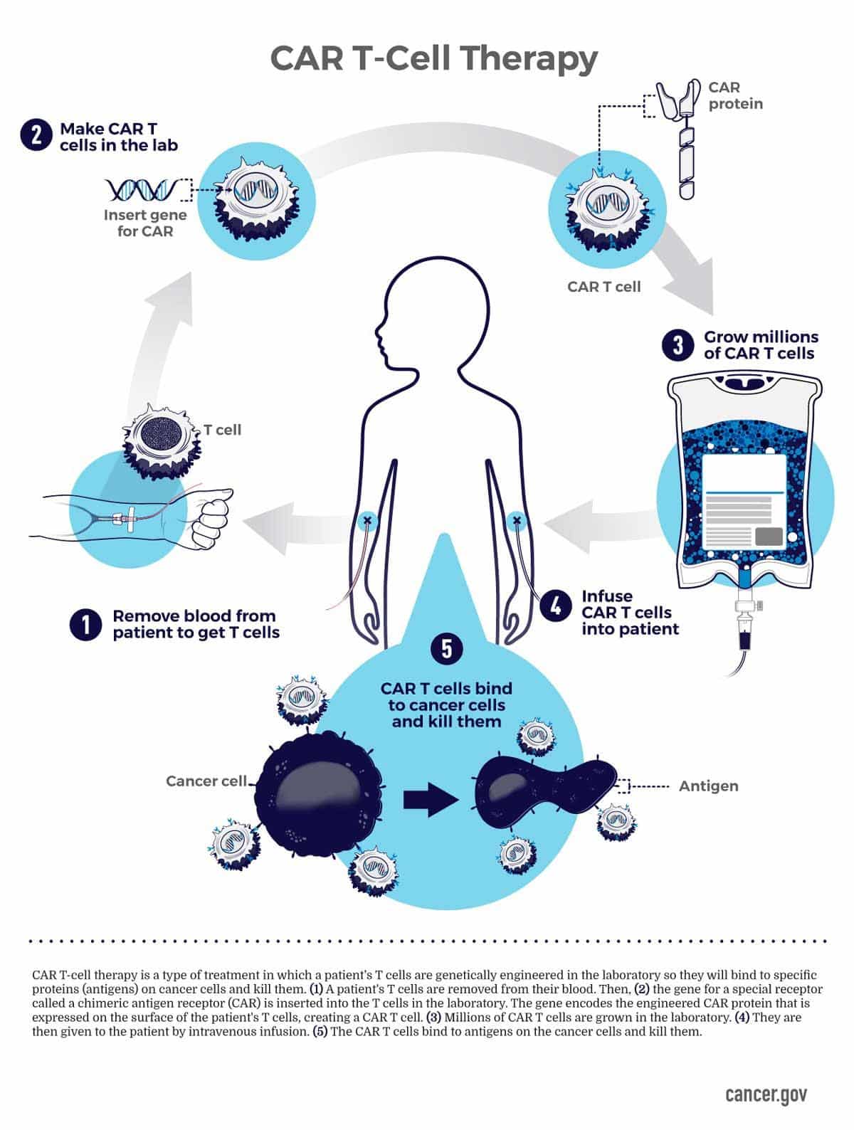 CAR T-Cell Therapy
