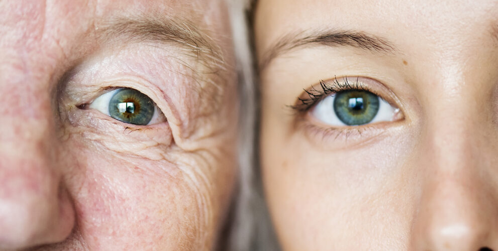 Age