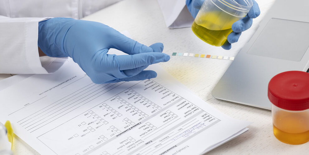 urine