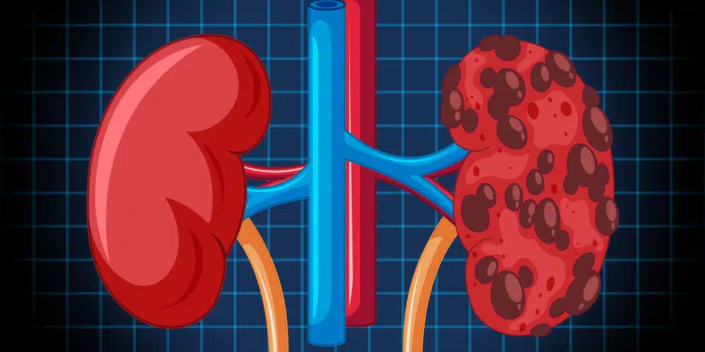 22-year ordeal ends: Court finds no kidney removal, acquits doctor