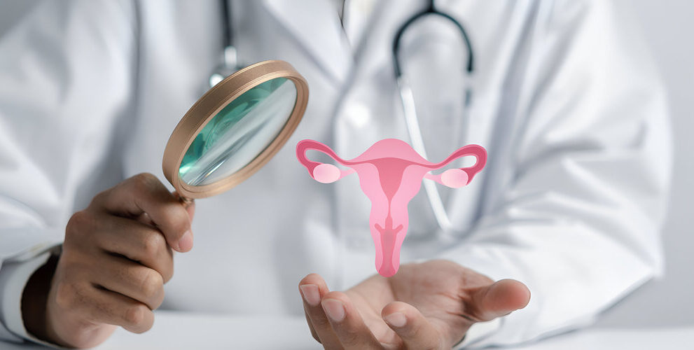 pcos