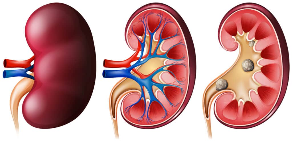 kidney