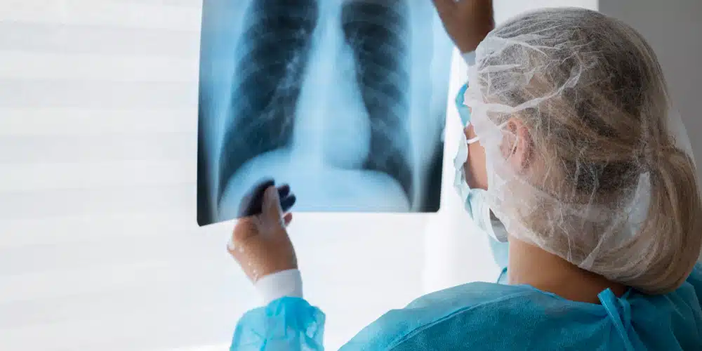 Could your diet be increasing your lung cancer risk? A new study says…