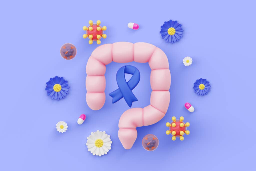 colorectal cancer