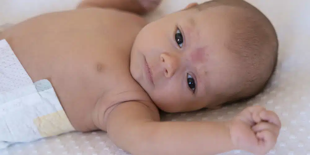 FACT CHECK: Are all rashes in babies a sign of chickenpox?