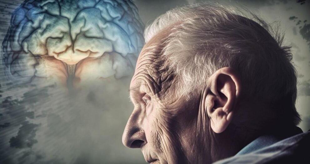 Alzheimer’s