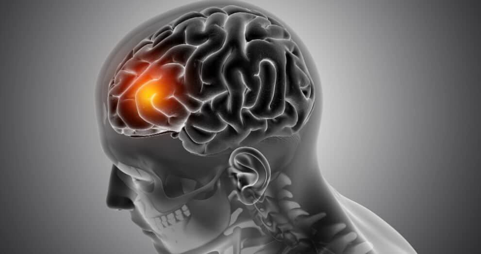 brain